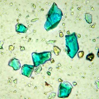 microphotograph-azurite