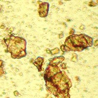 Chrome-yellow-pigment-microphotograph