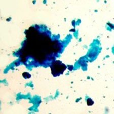 microphotograph-prussian-blue