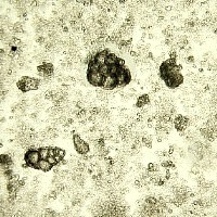 calcite-Chalk-microphotograph