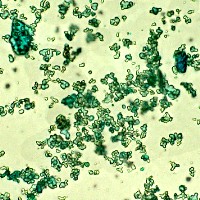 cerulean-blue-microphotograph