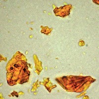 microphotograph-indian-yellow